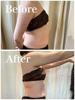 小顔屋ゆらやぎ/