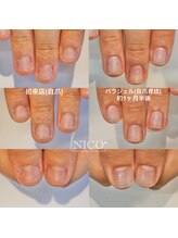 ニコプラス(NICO+)/自爪育成中