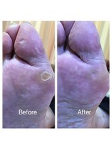 フスウントシューカルチャー 浅草本店/ビフォアフター写真