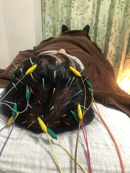 インフィニティ/眠れる☆育毛を促進する電気鍼