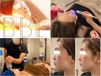 ぶっちょシャイン(ぶっちょShine)の写真/お肌の救世主BBL！ご好評│複数の肌トラブルの改善＋美肌」│同時集中ケア出来るBBL」男女ともに人気