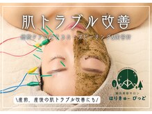 はりきゅーぴっど 大阪心斎橋