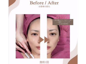 フィルドリップサロン 田園調布本店