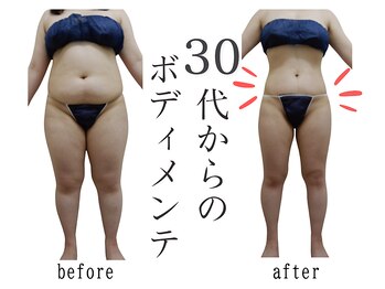 プレリー 自由が丘店/バキューム／筋膜リリース