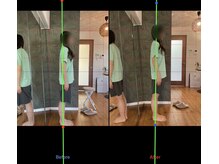 ハウオラ 三軒茶屋(HAUOLA)/整体/美容鍼灸/ヘッドスパ鍼