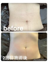 ギンザアール(GINZA R.)/くびれボディに♪