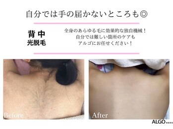 アルゴ 熊本健軍店(ALGO)/自分では手の届かないところも◎