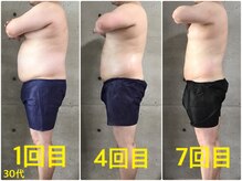 ペリー(PELLY)/男性30代　before after