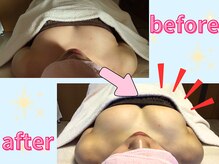 アイリスグリーン 名古屋伏見店(Airis green)/ビフォーアフター