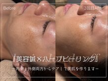 ハリサロンドオフ 西梅田店(hari salon de off)