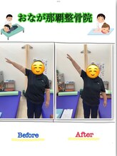 おなが浦添当山整体院/肩可動域改善！