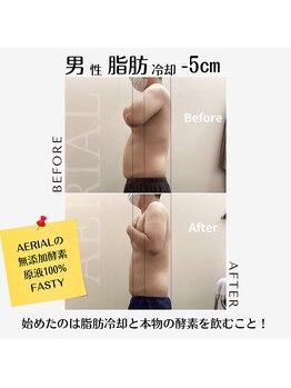 エアリアル 武雄店/メンズ脂肪冷却痩身