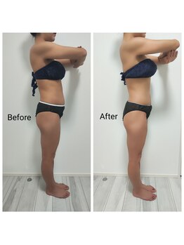 ビー アンド エイチ(B&H)/インディバボディ（1回施術）