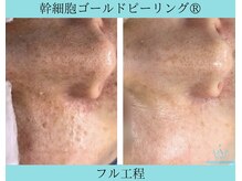 リメイククリニカルビューティー(Remake clinical beauty)/老けて見える原因は？