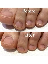 メリーミー(Merry me)/トータルフットケア　