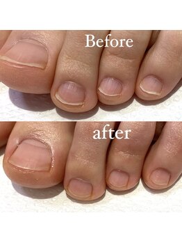 メリーミー(Merry me)/トータルフットケア　