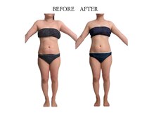 ヨサパーク サノン(YOSA PARK Sanon)/見た目痩せを叶える！