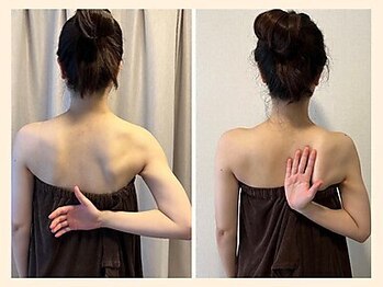 ラフリー 大宮院(RUFFREE)/肩甲骨もくっきり変化