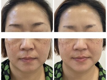 シミケア専門店 SAKURA 平塚店/コロナ対策徹底しております。