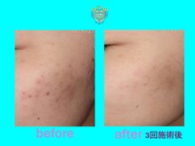 リュクス(LUXE)/ビフォーアフター