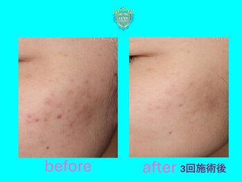 リュクス(LUXE)/ビフォーアフター