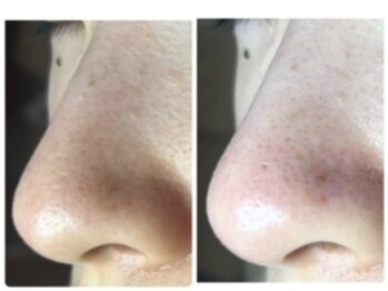 ミント/触り心地がつるん！びっくり！