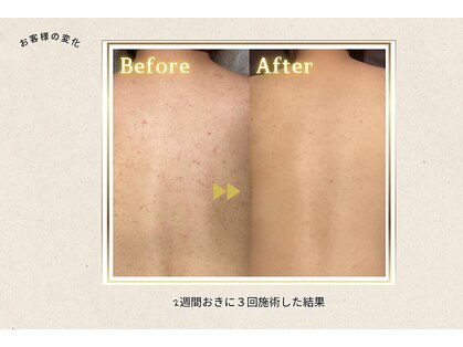 ピュアスキンサロン 恵比寿店(pure skin salon)の写真