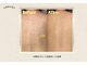 ピュアスキンサロン 恵比寿店(pure skin salon)の写真