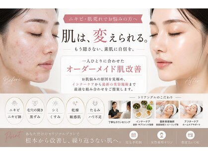 トリアングル(TLIENGLE)の写真