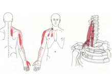 バズ カイロプラクティック(VAZ)/痺れにもパターンがあります。