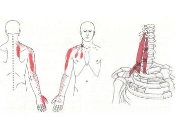 バズ カイロプラクティック(VAZ)/痺れにもパターンがあります。