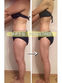 ピースツリー(PEACE TREE)/全身トータルで脂肪アプローチ