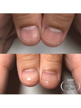 ネイルサロン キュービット(Q-bit)/