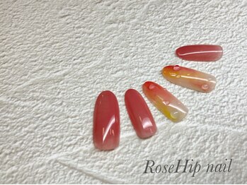 ローズヒップ(Rose Hip)/パラジェル定額6600円