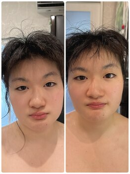 アンベリール(EMBELLIR)/デコルテ～フェイシャルエステ