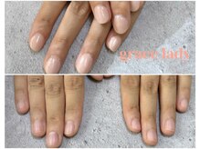 グレースレディ/矯正しながらカラーも！