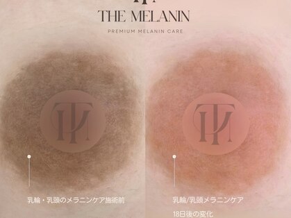 リュクス(Luxe)の写真