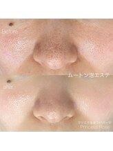 KIREI SHARE by princess rose マツエク/まつげパーマ/眉毛/メンズ/脱毛/フェイシャル/