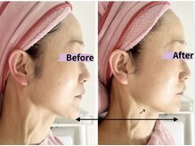 マリア(MALIA)/輪郭スッキリ小顔