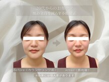 ステップ木更津鍼灸治療院/理学療法士+小顔矯正×美容整体