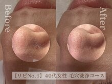 ディレイア ザ コスメ 有楽町マルイ店(direia the cosme)/角栓/毛穴洗浄/毛穴［有楽町］