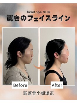 ノウ(NOU.)/那覇ヘッドスパ／那覇小顔矯正