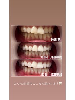 ブリエ 久屋大通店(BRILLER)/