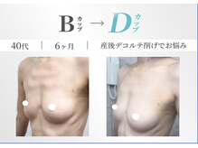 美人バスト 千早店の雰囲気（福岡市バストアップ★口コミランキング No.1獲得★AA→Fカップも）
