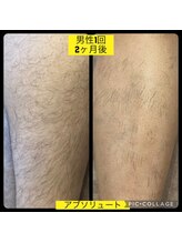 アブソリュート(absolute)/結果が早い脱毛サロン