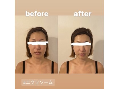 キハダ(ki.ha.da)の写真