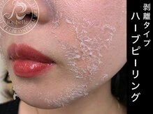 ビーエフジー(B F G)