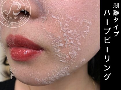 ビーエフジー(B F G)の写真