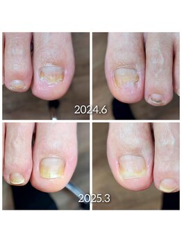 爪切り屋 足楽/