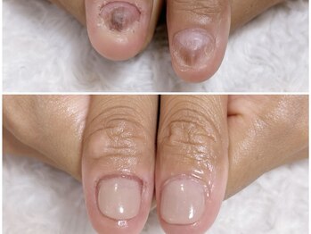 グラシナ 鳥丸店/2時間で見た目が変わります